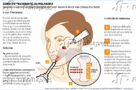 Como  o tratamento da melanoma