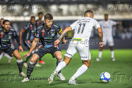 BRASILEIRO B 2024, SANTOS X OPERARIO