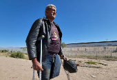 Venezolano llega con un solo pie a la frontera de Mxico en busca de una prtesis en EE.UU