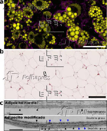 Cientficos desvelan cmo las clulas grasas protegen el cuerpo del exceso calrico