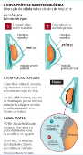 A nova prótese nanotecnológica