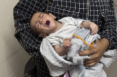 Madres, bebés y médicos hambrientos en el único hospital que trata la desnutrición en Gaza