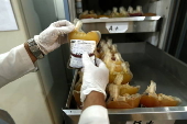 Blood transfusion of patients on World Thalassemia Day in Pakistan