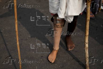 International Day of People with Disabilities observed in Kolkata