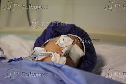 An injured girl is treated in a hospital, in Tehran