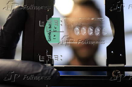 Florida International University's investigation on Alzheimer's disease early detection