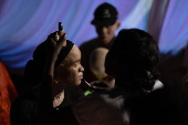 Models with albinism take part in fashion show promoting skin cancer awareness