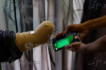 Technician uses a mobile phone for 3D scan of a patient before develping a prosthetic limb at the Bioniks Private Limited, in Karachi
