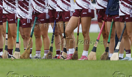 All-Ireland Senior Camogie Championship - Galway v Dublin - Ireland's Camogie players have won the right to wear shorts