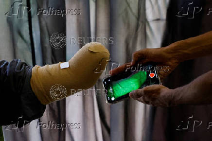Technician uses a mobile phone for 3D scan of a patient before develping a prosthetic limb at the Bioniks Private Limited, in Karachi