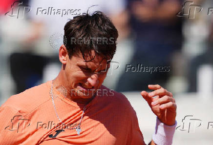 Italian Open