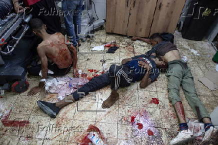 Cientos de palestinos heridos atendidos en el Hospital Nasser en Khan Younis