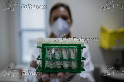 Exames de Covid-19 em laboratório em SP