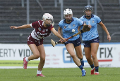 All-Ireland Senior Camogie Championship - Galway v Dublin - Ireland's Camogie players have won the right to wear shorts