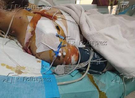 Dias movimentados no hospital de campanha de Saraya, na cidade de Gaza.