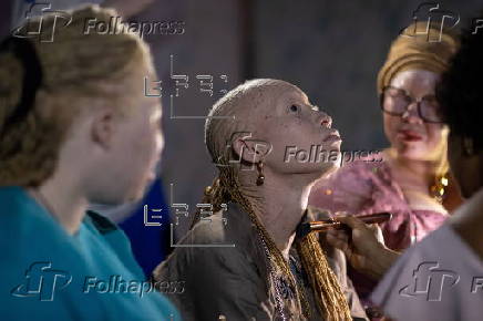 Models with albinism take part in fashion show promoting skin cancer awareness