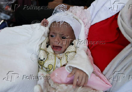 A health worker holds a Palestinian child who was brought to Jordan through King Hussein Bridge crossing to receive medical treatment, in Amman