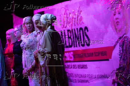 Models with albinism take part in fashion show promoting skin cancer awareness