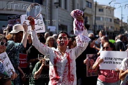 Israeli Arabs protest against famine in Gaza