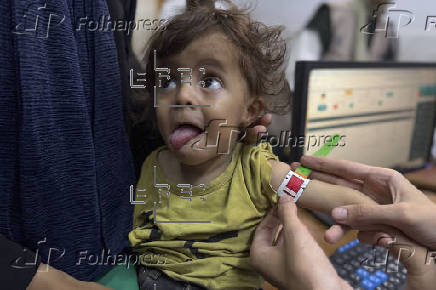 Madres, bebés y médicos hambrientos en el único hospital que trata la desnutrición en Gaza