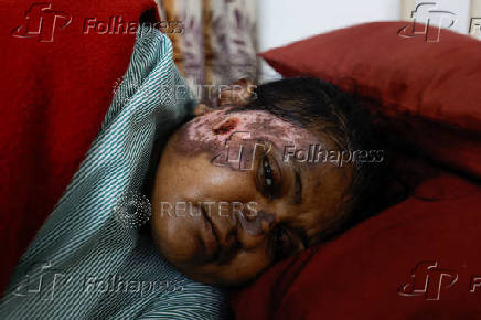Sita Patni, 45, who was injured after an Air India Boeing 787-8 Dreamliner plane crashed during takeoff from an airport, receives treatment in a private hospital, in Ahmedabad