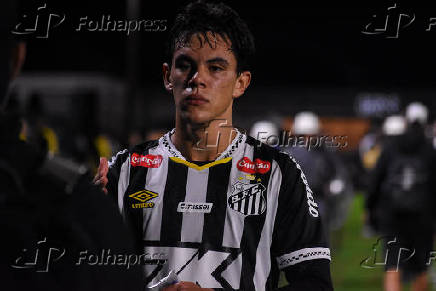 Santos x Red Bull Leipzig