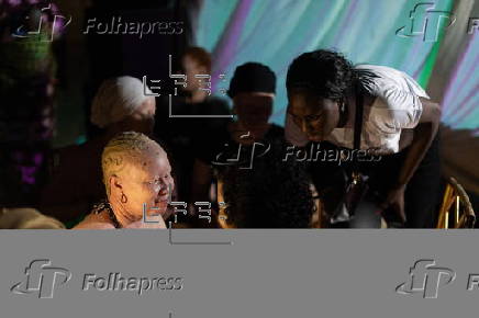 Models with albinism take part in fashion show promoting skin cancer awareness