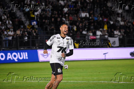 Santos x Red Bull Leipzig