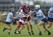 All-Ireland Senior Camogie Championship - Galway v Dublin - Ireland's Camogie players have won the right to wear shorts